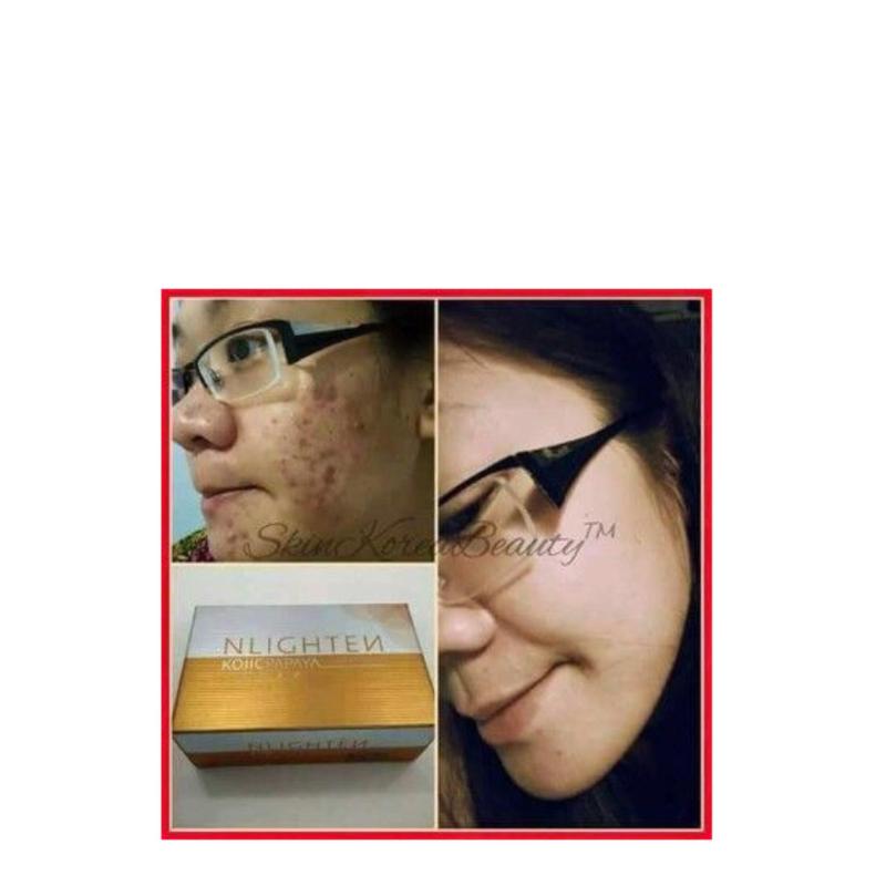 Buy NLIGHTEN KOJIC PAPAYA SOAP with Glutathione (135g) Singapore