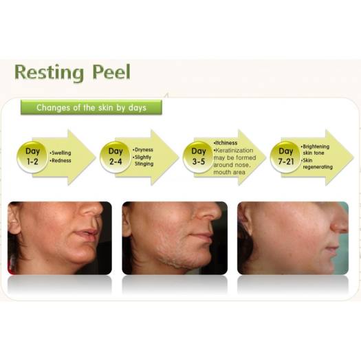 Lẻ 1 cặp chiết Peel da Ronas Resting Solution vi kim tảo biển Hàn Quốc - Thay da sinh học tại nhà