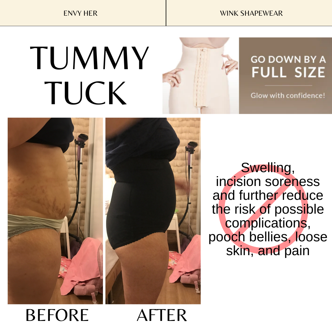 EXCLUSIVE SG DISTRIBUTOR]Wink® Shapewear - Tummy Tucker
