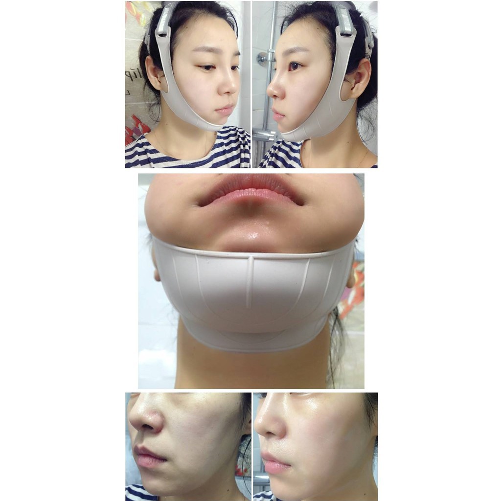 [HCM]Đai Nâng Cơ Chống Chảy Xệ Thon Gọn Mặt Massage Và Định Hình Gương Mặt Vline Its Well Plus