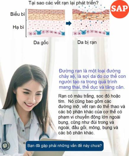 Kem Hết Rạn Da, Hết Sẹo Hiệu Quả Treatment Body Cream Thương Hiệu VIBRANT GLAMOUR Làm Trắng Và Săn Chắc Mịn Mượt Chống Lão Hóa