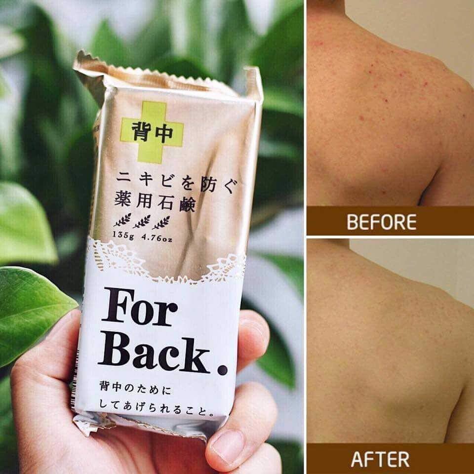 Xà phòng cải thiện mụn lưng Pelican For Back Medicated