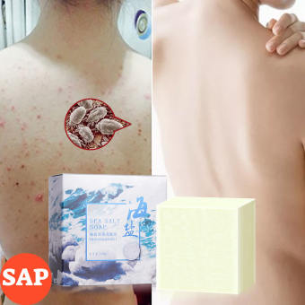 Xà Phòng Muối Biển Giúp Hết Bay Mụn Lưng, Mụn Mặt, Viêm Da Cánh Tay, Mụn Mông Thu Nhỏ Lỗ Chân Lông Sea Salt Soap Handmade Từ Bọt Biển, Sữa Dê