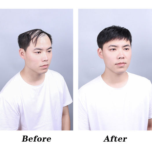 Tổng hợp 75 về các kiểu tóc giả nam đẹp hay nhất  Tin học Đông Hòa