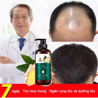 Dầu gội mọc tóc Dầu gội kích thích mọc tóc dầu gội chống rụng tóc 500ml,Giảm Gãy Rụng Dầu Gội Mọc Tóc Nhanh kiểm soát dầu loại bỏ gàu,ngăn ngừa rụng tóc, phục hồi tóc hư tổn