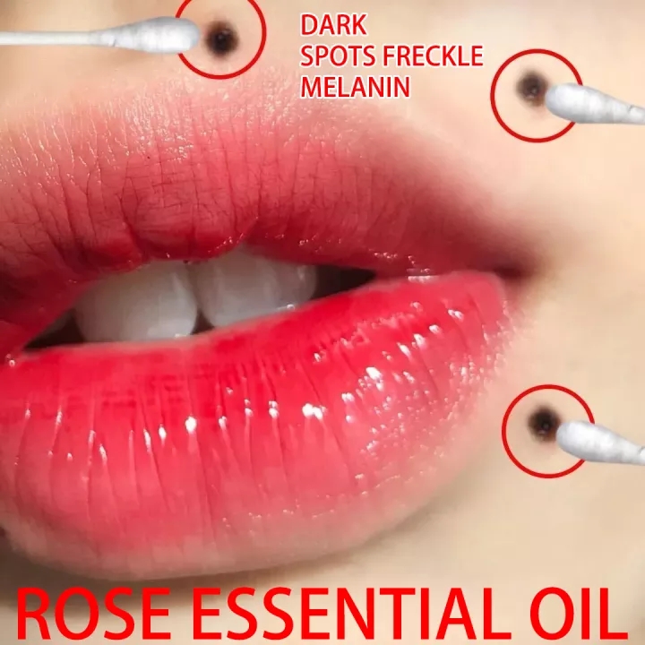 Gambar ?ready stock?Facial Removes mole  20ml Whitening Dark Spots Freckles Facial Skin Care serum