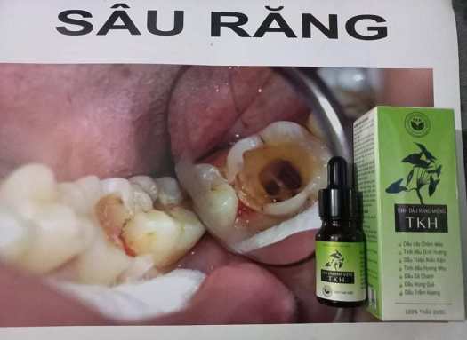 Tinh Dầu Răng Miệng TKH - Ngừa Sâu Răng Viêm Họng Ho Hiệu Quả