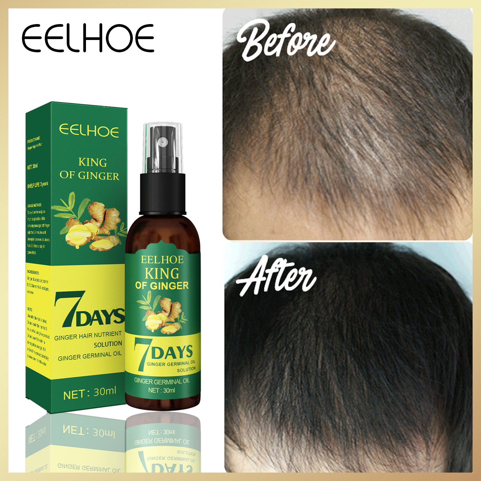 Gambar Eelhoe 7days Ginger Germinal Oil Hair Regrowth Spray Moisturizing Scalp Massage Hair Care Essence Anti Hair Loss Prevent Hair Dry Frizzy Thinning Hair Growth Nutrient Solution?30ml 50ml?