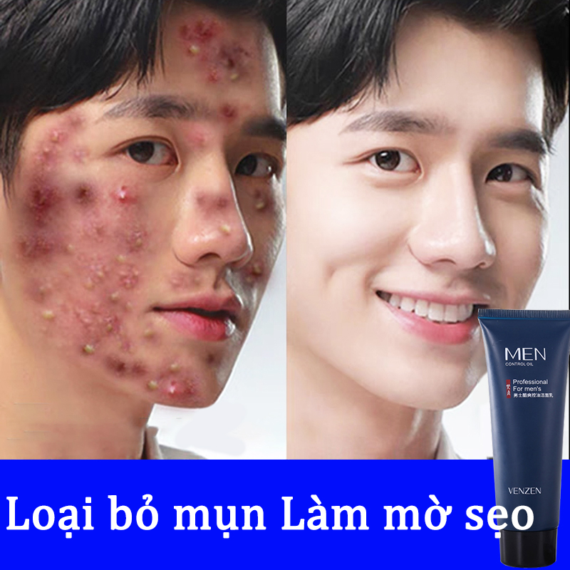 Sữa rửa mặt cho nam,Sữa rửa mặt loại bỏ mụn 80g axit amin nhẹ nhàng cho nam giới, giúp kiềm dầu ngừa mụn cho da mụn nhạy cảm, không chứa xà phòng