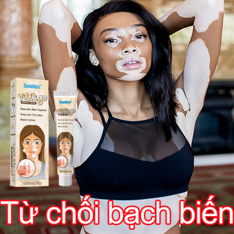 Kem bôi xóa bạch biến xóa đốm nám kem chăm sóc 20g loại bỏ vảy nến, bạch biến, bạch biến, hắc lào, làm đều màu da