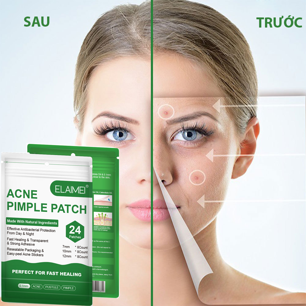 Hộp 24 Miếng Dán Mụn CẤP TỐC ELAIMEI Chống Thấm Nước, Mặt Nạ Mụn Giảm Mụn Thâm, Mụn Viêm