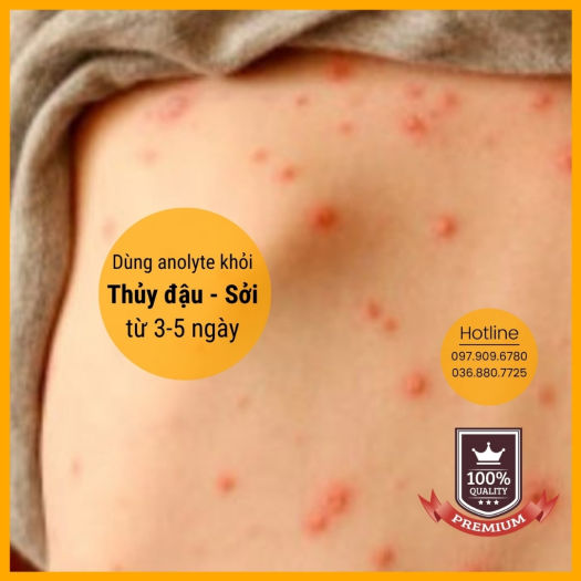 Dung dịch Anolyte KT (Nước A - Combo 3 chai 1,5lit)