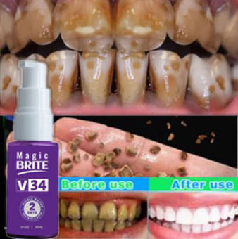 Tinh chất làm trắng răng làm trắng men vi sinh học Tinh chất làm trắng răng, 30ml, làm trắng làm sạch răng giữ tươi và giảm viêm nha chu