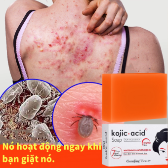 kojic acid Xà Phòng Tắm Xà Phòng Mụn Lưng Xà bông trắng da Giảm Thâm Xà Phòng Rửa Mặt Xà Bông Tắm Trắng Xà Phòng Làm Trắng Da Handmade Chăm Sóc Da Làm Sạch Sâu Dưỡng
