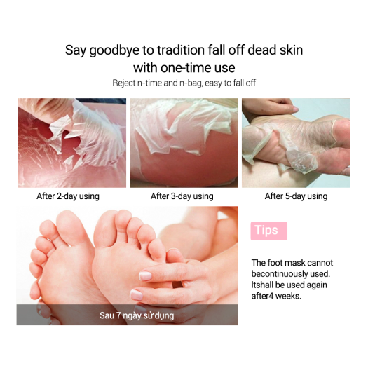 Troubled with peeling feet? Read to know why it happens - Times of India