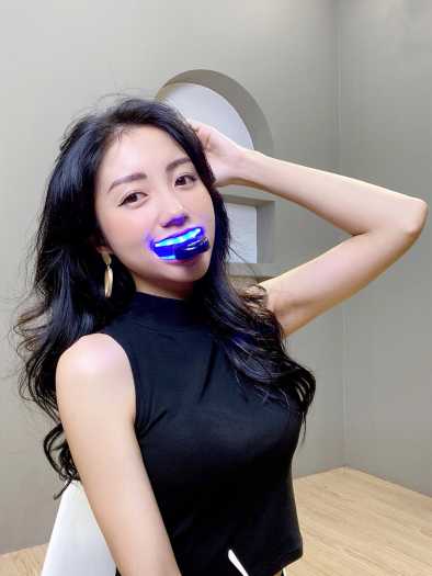 Smilee Extra-Tẩy trắng răng tại nhà Smilee cao cấp Extra Nhập USA hiệu quả gấp đôi