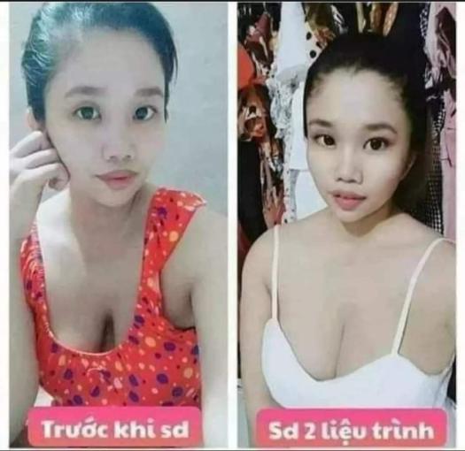 Kẹo mầm sâm tố nữ plus X2 thảo mộc 37 nở ngực siêu tốc HNBEATY