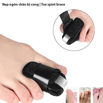 Nẹp ngón chân búa bị cong, nẹp có thanh kim loại định hình cho ngón chân thẳng