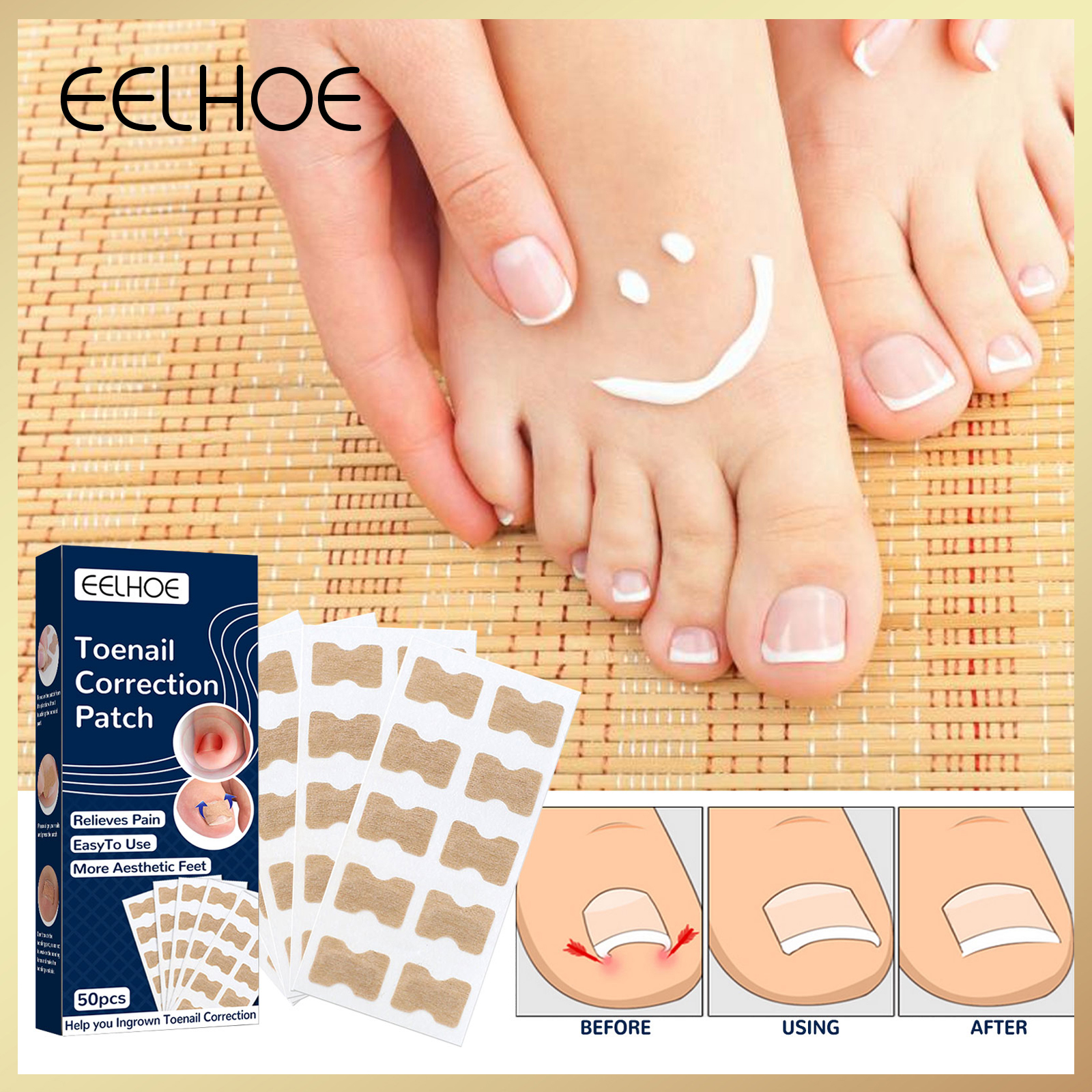 Gambar Eelhoe Toe Nail Correction Patch Foot Care Pedicure Tool Fixer Ingrown Toenail Corrector Sticker Paronychia Recover Toenail Elastic Patch Corrector Anti roll Nail Free Glue Toe Inlay Nail Corrector Patch?50pcs box?