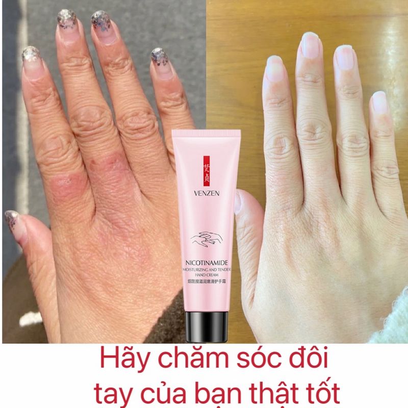 Trung quốc venzen kem phục hồi da chân tay kem dưỡng da tay tay hydrat hóa dưỡng ẩm làm trắng chống khô 50g kem dưỡng da tay dưỡng ẩm kem dưỡng ẩm và chống khô chăm sóc nuôi dưỡng 50ml