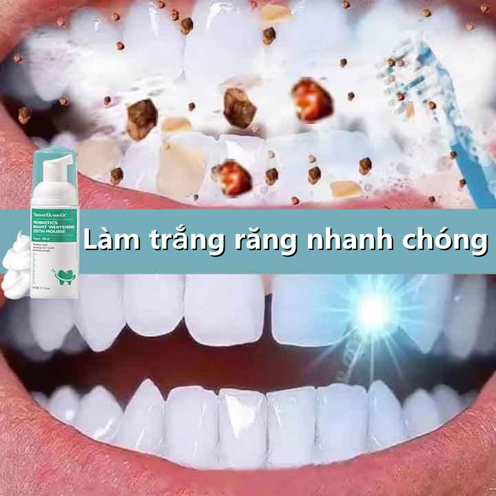 Kem đánh răng Whitening Teeth Mousse 【60ml】 Ngừa sâu răng, bảo vệ nướu, làm trắng răng, khử mùi hôi miệng, có thể nuốt với lượng nhỏ, không gây kích ứng, hương dâu, cho bé yêu đánh răng giảm ố vàng răng Khử mùi chống hôi miệng Ngăn ngừa sưng và đau nướu
