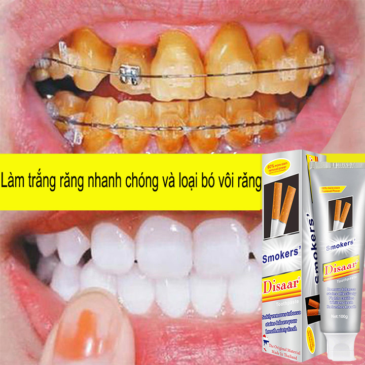 Làm trắng răng nhanh chóng  7 ngày, Loại bỏ hiệu quả các vết ố trên răng, vết khói, mảng bám, loại bỏ hôi miệng, cao răng, vàng răng, giúp sạch răng, hơi thở thơm tho