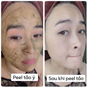 Peel Da vi tảo 7 ngày đẹp