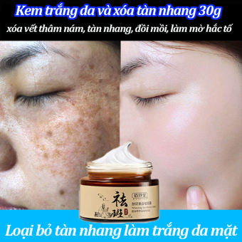 Kem xóa tàn nhang đồi mồi Kem Làm trắng Hot sale giảm giá Kem trắng da và xóa tàn nhang 30g Nám tàn nhang hiệu quảLàm mờ thâm nám tàn nhankem thâm nám tàn nhang đồi mồiSăn chắc da kem dưỡng ẩm