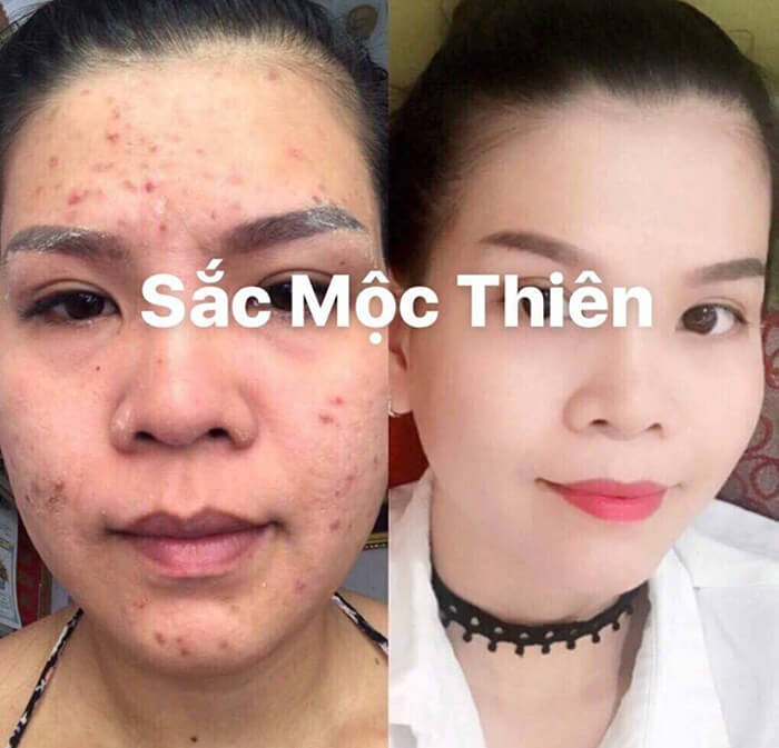 Nam Dược Tái tạo da 50ml Serum Tinh Chất Giúp Tái Tạo Thượng Đỉnh - tái tạo da hoàn toàn mới, là liệu pháp thay da sinh học