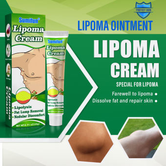 Lipoma Removal Cream Stretch Marks Relief and Burns Repair for Men & Women Acne Scars