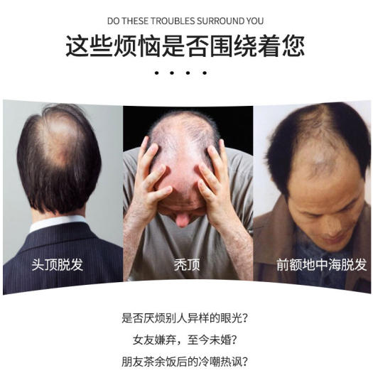 Tóc giả ngắn kiểu dán che trán đầu hói cho nam kiểu dáng tự nhiên thoáng khí không lộ - INTL