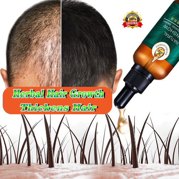 Gambar Herbal Hair Growth Thickens Hair Hair loss Hair fall Oily Scalp Treatment Hair growth Men Vitamin fast anti off hair occurs hair extension hair long hair agent 30ml