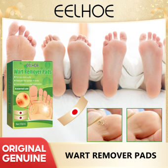 Eeelhoe mụn cóc loại bỏ mụn cóc plantar gai đau Relief miếng đệm bảo vệ ngón chân chăm sóc da dụng cụ làm móng Đệm Y Tế nhãn dán bảo vệ ngón chân bọt tròn gà miếng che mắt Đồ bảo vệ chân miếng