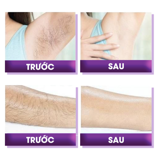 Combo Kem Tẩy Lông_ Seimy Pure Skin Perfect ( Gồm kem và serum dưỡng) Triệt Sạch Lông Chỉ Sau 5 Phút sử dụng