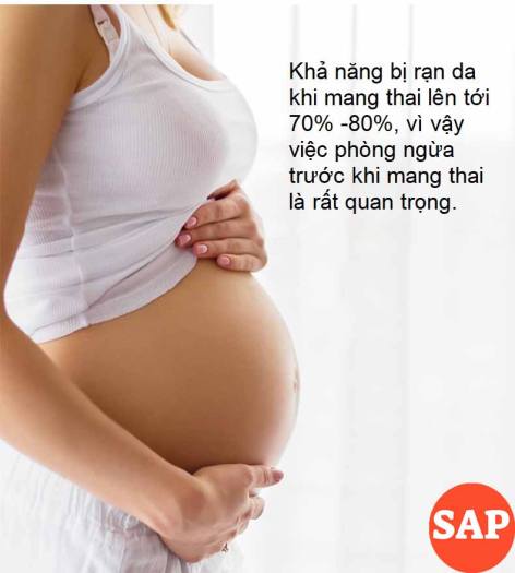 Kem Hết Rạn Da, Hết Sẹo Hiệu Quả Treatment Body Cream Thương Hiệu VIBRANT GLAMOUR Làm Trắng Và Săn Chắc Mịn Mượt Chống Lão Hóa