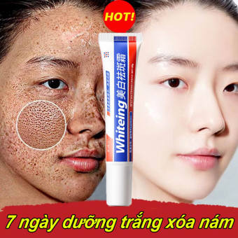Kem làm trắng và loại bỏ nám tàn nhang Kem nám và chống tàn nhang 20g Kem làm mờ vết thâm làm trắng da Serum xóa vết thâm làm sáng da, Giúp Dưỡng Trắng, Mờ Thâm Nám, Làn Da Đều Màu, giảm đốm tàn nhang, Cam Kết Sạch 95% Nám
