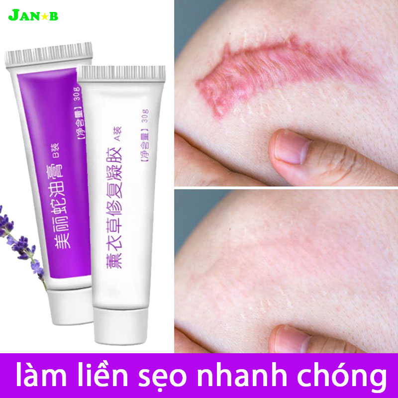 Kem trị sẹo , trị sẹo mổ, bỏng, phục hồi vết rạn da có thêm vaseline dưỡng da, làm mềm mịn da,