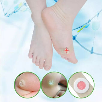 Miếng dán tẩy mụn cóc, mụn nhọt vết chai C32 (Hộp 36 miếng)