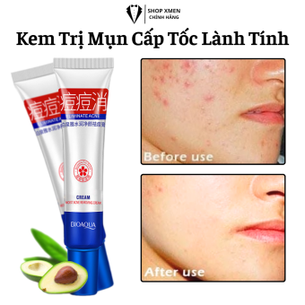 Kem Chấm Hết Sạch Mụn Ẩn Mụn Viêm Mụn Sung Mụn Bọc Mụn Đầu Đen Trên Da Phục Hồi Vết Thâm Mụn Nhanh Chóng