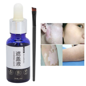 Dung Dịch Che Phủ Bạch Biến Mỹ Phẩm Che Khuyết Điểm Chống Nước Cho Mặt Cơ Thể 20Ml