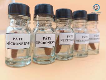 Diệt Tuỷ Việt Nam -Diệt tuỷ Pâte Nécronerver- Sử dụng trong Nha Khoa.