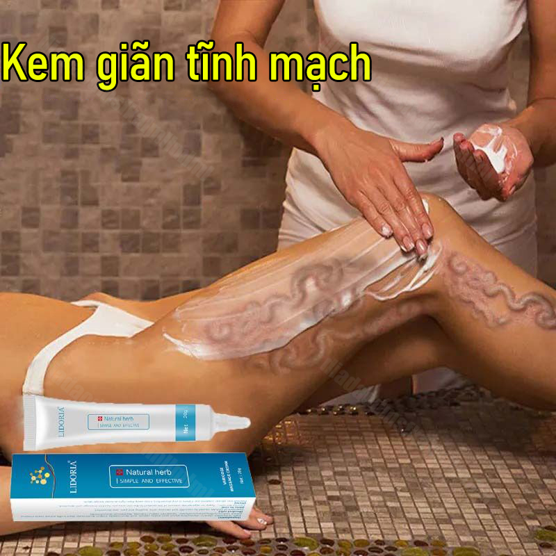 Kem ngăn ngừa suy giãn tĩnh mạch giảm đau nhức do suy giãn tĩnh mạch màng nhện có hiệu quả loại bỏ suy giãn tĩnh mạch tốt kem làm dịu chứng suy giãn tĩnh mạch kem loại bỏ chứng suy giãn tĩnh mạch chống suy giãn tĩnh mạch tĩnh mạch chân loại bỏ hiệu quả hà