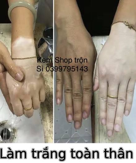 Công thức kem trộn siêu trắng nhanh