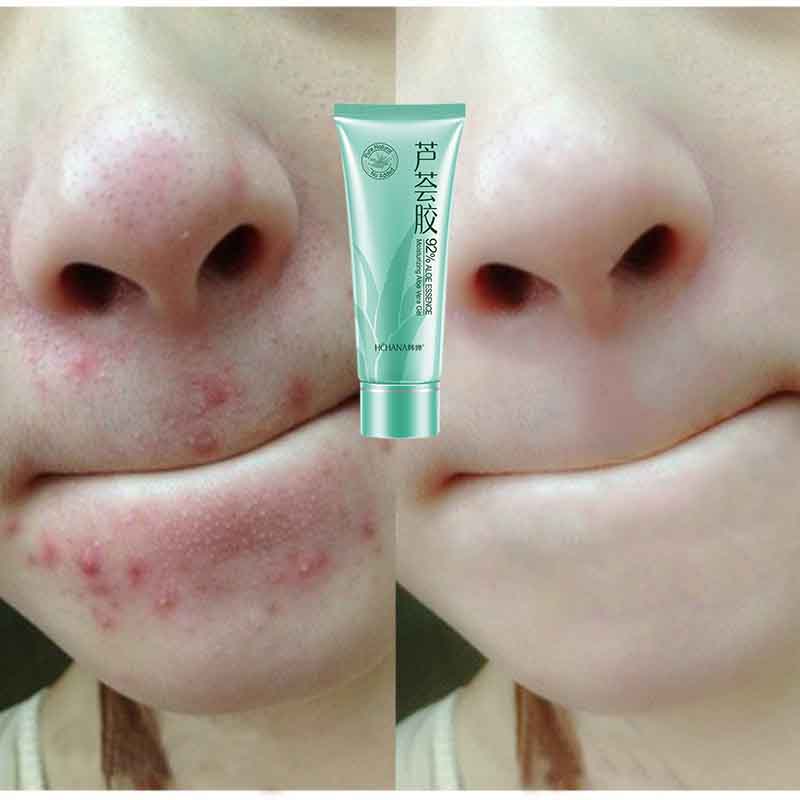 Gel lô hội hoàn hảo tự nhiên dành cho da nhạy cảm 40g