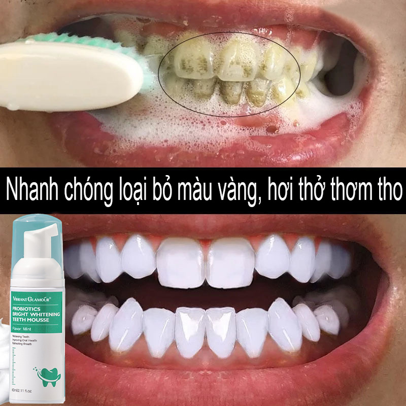 Kem làm trắng răng (Làm trắng răng nhanh chóng) Kem đánh răng dạng bọt giúp Vệ sinh răng miệng Loại bỏ hiệu quả các vết ố vàng trên răng, vết ố do khói thuốc, loại bỏ mảng bám trên răng, Kem đánh răng khử hôi miệng Cao răng, Dụng cụ làm sạch răng màu vàng
