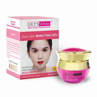 Kem dưỡng trắng da Lily’s White (Tinh Chất Nhau thai cừu ))