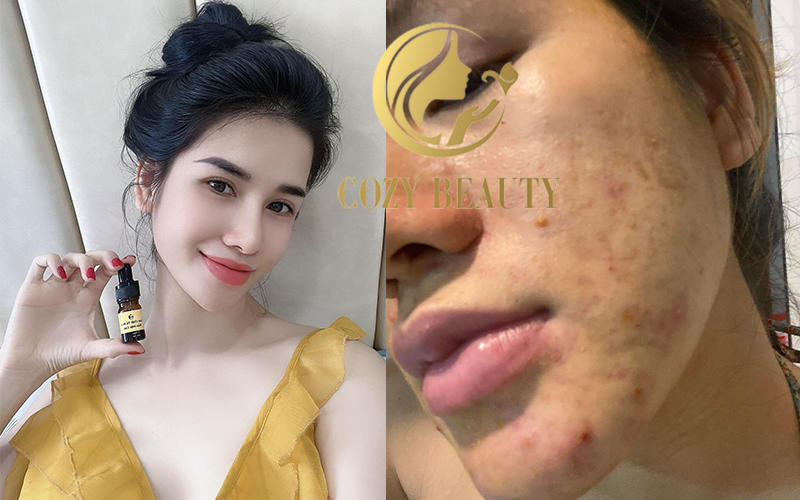 Serum face