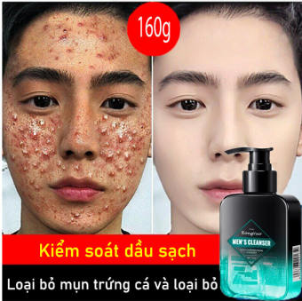 Sữa Rửa Mặt Nam Sáng Da Giảm Mụn 160g dành cho nam giúp sáng da sạch sâu kiềm dầu giảm mụn thâm hiệu quả