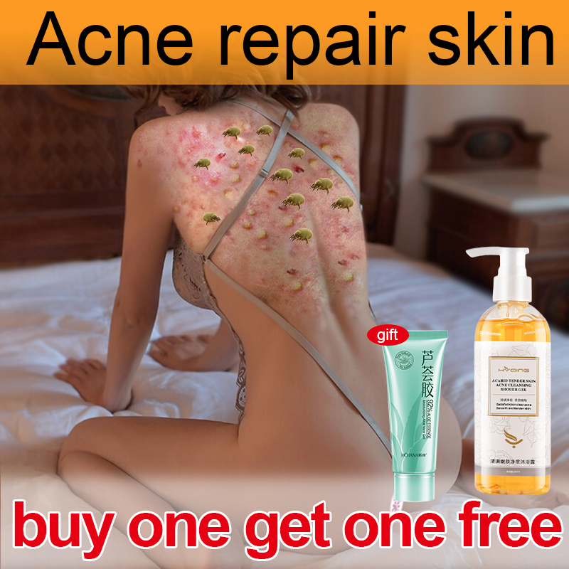 Gambar Whitening Body Wash Anti Acne Natural Perfume Shower Gel For Dry Acne Itchy Skin Antibacterial Body Cleanser Bath Gel Hot Whitening Body Wash Shower Gel Whole Body Fast Whitening Wash Whitening Cleaning Gel
