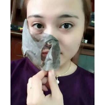 Màng Tế Bào Gốc Trắng Da Thải Độc Mờ Nám Sạm Tàn Nhang Hết Mụn